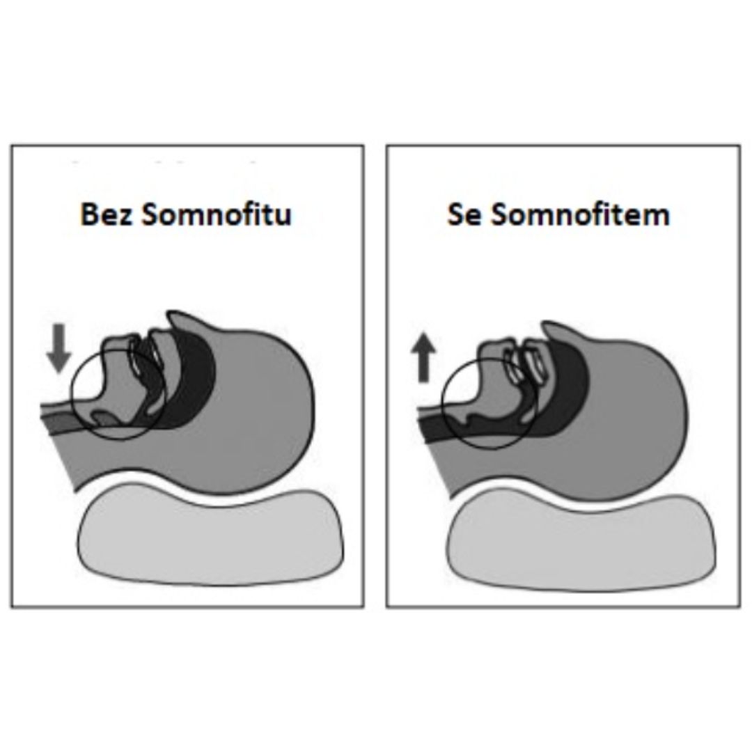 Somnofit pomůcka proti chrápání